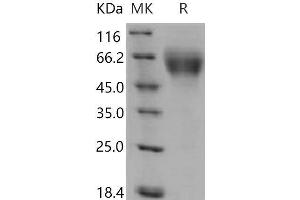 Western Blotting (WB) image for Tumor Necrosis Factor Receptor Superfamily, Member 21 (TNFRSF21) (Active) protein (His tag) (ABIN7320343)