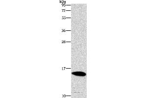 Western blot analysis of Mouse brain tissue, using CST4 Polyclonal Antibody at dilution of 1:1450 (CST4 anticorps)