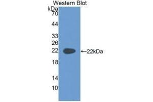 Detection of Recombinant KRT4, Rat using Monoclonal Antibody to Cytokeratin 4 (CK4) (KRT4 anticorps  (AA 317-454))