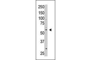 The CREB3L1 polyclonal antibody  is used in Western blot to detect CREB3L1 in A-375 cell lysate. (CREB3L1 anticorps  (C-Term))
