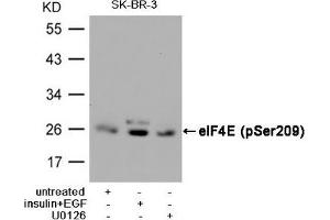 Western blot analysis of extracts from SK-BR-3 cells, untreated or insulin and EGF treated, and pretreated with U0126 cells, using eIF4E (Phospho-Ser209) Antibody. (EIF4E anticorps  (pSer209))