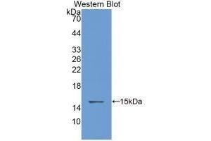 Detection of Recombinant CSTB, Rat using Monoclonal Antibody to Cystatin B (CSTB)