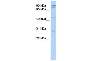 HAX1 antibody used at 1 ug/ml to detect target protein. (HAX1 anticorps  (Middle Region))