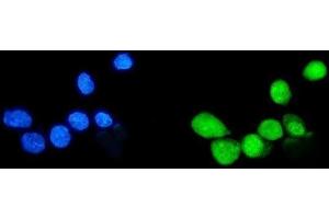 IF analysis of Sumo 1/SUMO1 using anti-Sumo 1/SUMO1 antibody (ABIN7603002). (SUMO1 anticorps  (Middle Region))