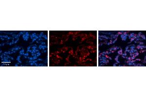Rabbit Anti-FOLR1 Antibody     Formalin Fixed Paraffin Embedded Tissue: Human Lung Tissue  Observed Staining: Membrane and cytoplasmic in alveolar type I & II cells  Primary Antibody Concentration: 1:100  Other Working Concentrations: 1/600  Secondary Antibody: Donkey anti-Rabbit-Cy3  Secondary Antibody Concentration: 1:200  Magnification: 20X  Exposure Time: 0.