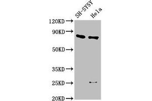 Western Blot Positive WB detected in: SH-SY5Y whole cell lysate, Hela whole cell lysate All lanes: CTNNB1 antibody at 2. (CTNNB1 anticorps  (AA 2-781))