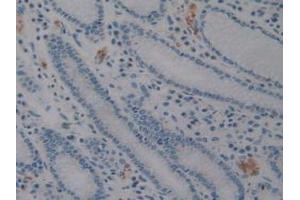 Detection of CD56 in Human Stomach Tissue using Polyclonal Antibody to Cluster Of Differentiation 56 (CD56)