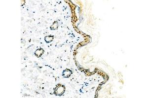 Immunohistochemistry of paraffin embedded rat skin using hmgn1 (ABIN7074222) at dilution of 1: 1800 (200x lens)
