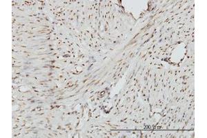 Image no. 1 for anti-Zinc Fingers and Homeoboxes 2 (ZHX2) (AA 691-789) antibody (ABIN599184) (ZHX2 anticorps  (AA 691-789))