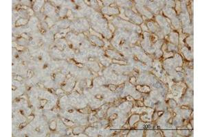 Image no. 1 for anti-EH-Domain Containing 3 (EHD3) (AA 357-407) antibody (ABIN599233) (EHD3 anticorps  (AA 357-407))