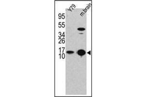 Western blot analysis of LC3B Antibody (LC3B anticorps  (N-Term))