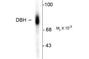 Image no. 1 for anti-Dopamine beta-Hydroxylase (Dopamine beta-Monooxygenase) (DBH) (C-Term) antibody (ABIN372611) (DBH anticorps  (C-Term))