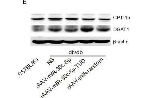 rAAV-miR-30c-5p attenuated hepatic steatosis in db/db mice(A and B) Histological analysis of hepatocyte by H&E and Oil Red O staining. (beta Actin anticorps)