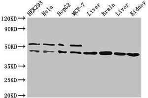 Western Blot Positive WB detected in: HEK293 whole cell lysate, Hela whole cell lysate, HepG2 whole cell lysate, MCF-7 whole cell lysate, Rat liver tissue, Mouse brain tissue, Mouse liver tissue, Mouse kidney tissue All lanes: IDH1 antibody at 2 μg/mL Secondary Goat polyclonal to rabbit IgG at 1/50000 dilution Predicted band size: 47 kDa Observed band size: 47, 52 kDa (IDH1 anticorps  (AA 1-240))
