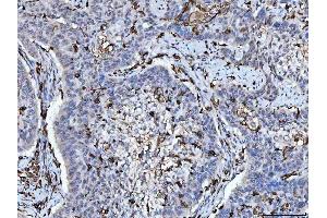 IHC analysis of HLA-DRA using anti-HLA-DRA antibody (ABIN7600948). (HLA-DRA anticorps  (AA 26-254))