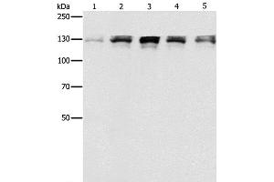 Western Blot analysis of Human fetal small intestine, liver cancer and Lymphoma Lymphoma, 293T and A549 cell using DDB1 Polyclonal Antibody at dilution of 1:500 (DDB1 anticorps)