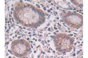 DAB staining on IHC-P; Samples: Human Stomach Tissue