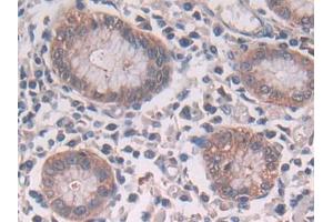 DAB staining on IHC-P; Samples: Human Stomach Tissue (CBL anticorps  (AA 558-816))