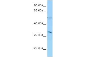 WB Suggested Anti-CD1B Antibody Titration: 1. (CD1b anticorps  (N-Term))