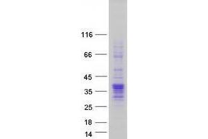 Validation with Western Blot (VGLL4 Protein (Transcript Variant 1) (Myc-DYKDDDDK Tag))