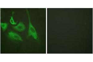 Immunofluorescence analysis of HeLa cells treated with TNF-a 20nM 15', using HSP90B (Phospho-Ser254) Antibody.