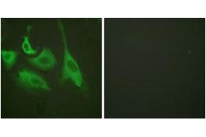 Immunofluorescence analysis of HeLa cells treated with TNF-a 20nM 15', using HSP90B (Phospho-Ser254) Antibody. (HSP90AB1 anticorps  (pSer254))