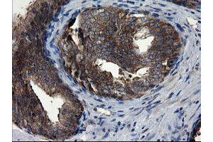 Image no. 7 for anti-CCR4-NOT Transcription Complex Subunit 4 (CNOT4) (AA 190-455) antibody (ABIN1491098) (CNOT4 anticorps  (AA 190-455))