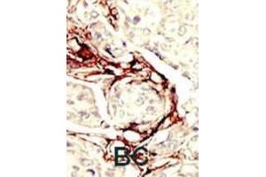 Immunohistochemistry (IHC) image for anti-serine/threonine Kinase 11 (STK11) antibody (ABIN3003070)