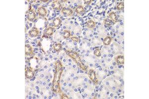 Immunohistochemistry (IHC) image for anti-Kelch-Like ECH-Associated Protein 1 (KEAP1) (AA 325-624) antibody (ABIN3022609)