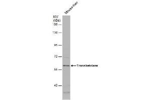 WB Image Mouse tissue extract (50 μg) was separated by 7. (TKT anticorps)