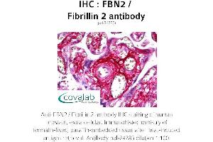 Image no. 1 for anti-Fibrillin 2 (FBN2) antibody (ABIN1734298)