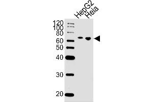 Lane 1: HepG2 Cell lysates, Lane 2: HeLa Cell lysates, probed with NLK (1146CT24. (Nemo-Like Kinase anticorps)
