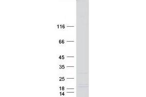 Validation with Western Blot