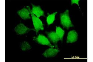 Immunofluorescence of purified MaxPab antibody to PLCXD1 on HeLa cell.