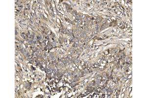 IHC analysis of EIF4EBP1 using anti-EIF4EBP1 antibody (ABIN7602881).