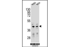 Western blot analysis in K562,WiDr cell line lysates (35ug/lane). (TFB2M anticorps  (C-Term))