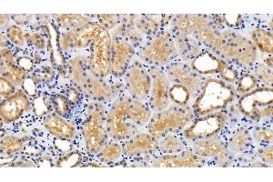 Detection of SQSTM1 in Human Kidney Tissue using Polyclonal Antibody to Sequestosome 1 (SQSTM1) (SQSTM1 anticorps  (AA 136-400))
