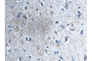 Detection of TGFbI in Human Cerebrum Tissue using Polyclonal Antibody to Transforming Growth Factor Beta Induced Protein (TGFbI)