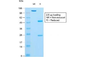 SDS-PAGE Analysis Purified Insulin Mouse Recombinant Monoclonal Antibody (rIRDN/805). (Recombinant Insulin anticorps)