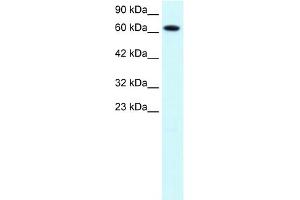 WB Suggested Anti-PIAS3 Antibody Titration:  1. (PIAS3 anticorps  (C-Term))