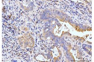 IHC analysis of Golgin 97/GOLGA1 using anti-Golgin 97/GOLGA1 antibody (ABIN7599539). (GOLGA1 anticorps  (AA 1-752))