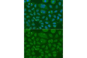 Immunofluorescence analysis of A549 cell using ANXA8L2 antibody. (ANXA8L2 anticorps)