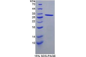 Image no. 1 for Signaling Lymphocytic Activation Molecule Family, Member 5 (AA 32-222) protein (His tag) (ABIN6238299)
