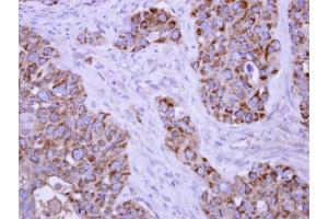IHC-P Image TUFM antibody detects TUFM protein at mitochondria on H441 xenograft by immunohistochemical analysis. (TUFM anticorps)