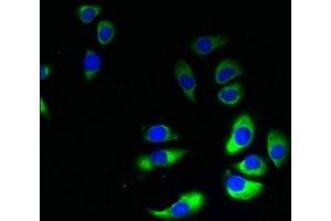 Immunofluorescent analysis of A549 cells using ABIN7154384 at dilution of 1:100 and Alexa Fluor 488-congugated AffiniPure Goat Anti-Rabbit IgG(H+L) (GRAMD1B anticorps  (AA 235-504))