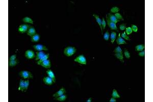 Immunofluorescent analysis of HepG2 cells using ABIN7169080 at dilution of 1:100 and Alexa Fluor 488-congugated AffiniPure Goat Anti-Rabbit IgG(H+L)