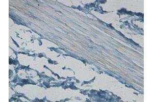 Immunohistochemical staining of formalin-fixed paraffin-embedded human stomach tissue showing cytoplasmic staining with CNN1 polyclonal antibody  at 1 : 100 dilution.