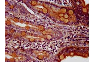 IHC image of ABIN7155790 diluted at 1:200 and staining in paraffin-embedded human small intestine tissue performed on a Leica BondTM system.