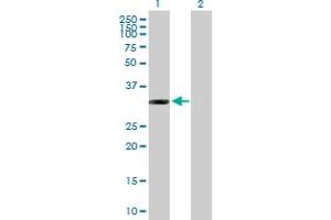Western Blot analysis of ITPK1 expression in transfected 293T cell line by ITPK1 MaxPab polyclonal antibody. (ITPK1 anticorps  (AA 1-314))