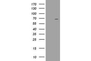 Image no. 16 for anti-DEAD (Asp-Glu-Ala-Asp) Box Polypeptide 59 (DDX59) (AA 1-303) antibody (ABIN1490728) (DDX59 anticorps  (AA 1-303))